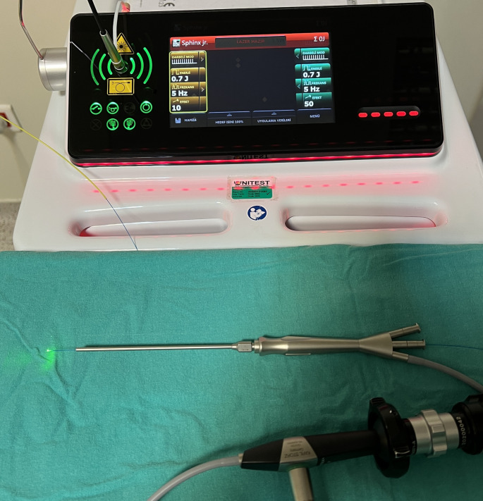 Submandibular sialolithiasis treatment: a comparative pilot prospective study of holmium: YAG laser and pneumatic lithotripsy techniques.