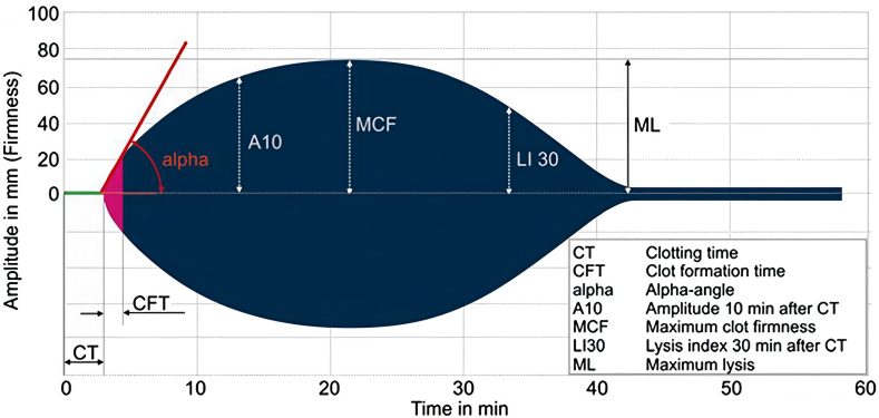 The effect of tranexamic acid on blood coagulation in primary total hip arthroplasty using rotational thromboelastometry: a randomized controlled trial.