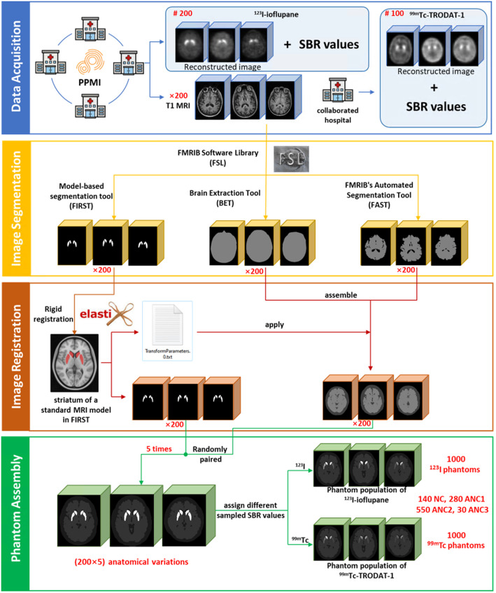 Development of a population of digital brain phantoms for radionuclide imaging research in Parkinson's disease.