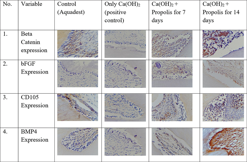Improvement of Dentin Growth Parameters (Beta-catenin, bFGF, CD105, and BMP4) with Propolis as Adjuvant in Dental Caries Treatment.