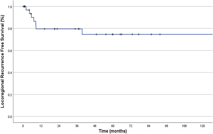 Carcinoma ex Pleomorphic Adenoma: Multi-Institutional Retrospective Cohort Study.