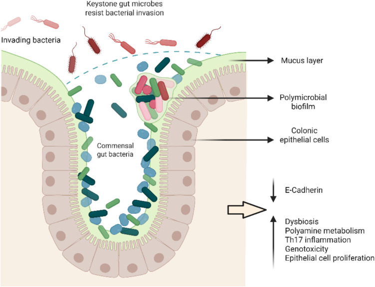 Colorectal cancer biofilm composition reveals distinct bacterial species signature