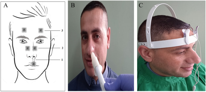 Ocular neuromodulation as a novel treatment for retinitis pigmentosa: identifying rod responders and predictors of visual improvement.