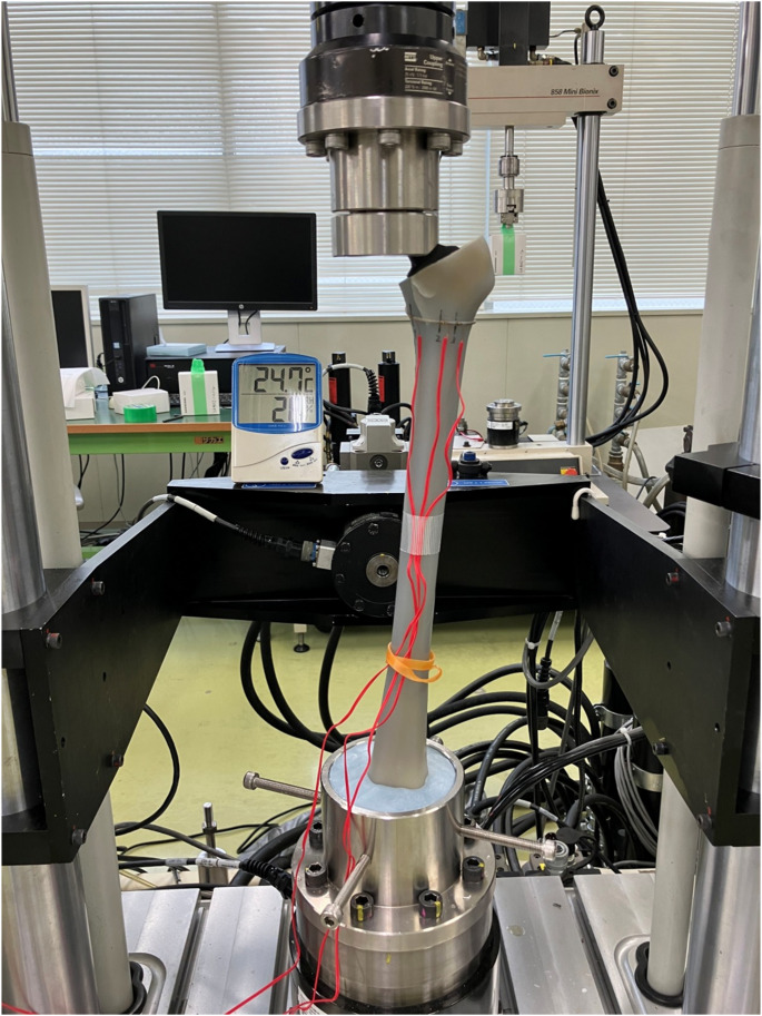 Biomechanical comparison of cemented versus cementless fixation in intraoperative femoral fractures during total hip arthroplasty.
