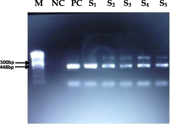 Effects of serial passaging of field isolates of Bangladeshi PPR virus in Vero cells on the fusion protein.