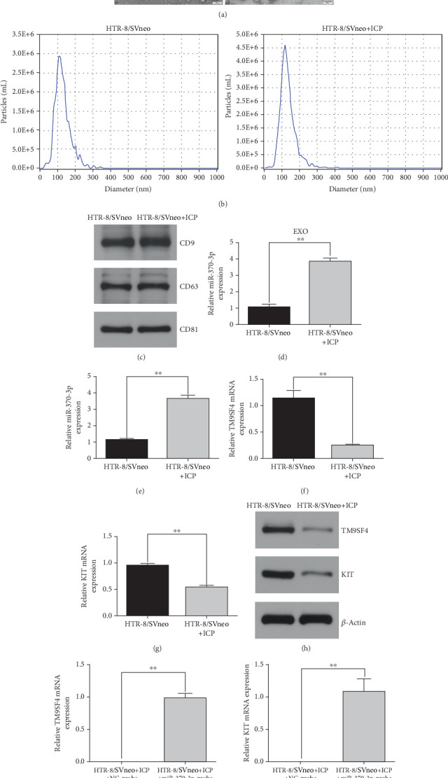 Yinchenhao Decoction Protects Against Intrahepatic Cholestasis During Pregnancy Through the miR-370-3p/TM9SF4/KIT Axis.