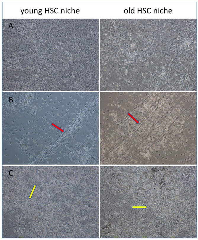 Differential effects of young and old hematopoietic stem cell niches on bone marrow-derived dendritic cells.