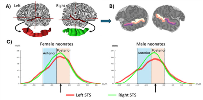 Functional connectivity of the superior temporal sulcus at term-equivalent age: effects of gestational age and sex.