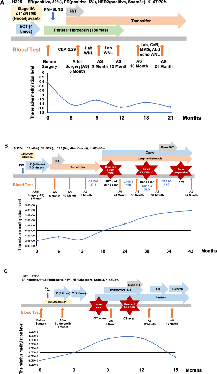 Monitoring breast cancer progression through circulating methylated GCM2 and TMEM240 detection.