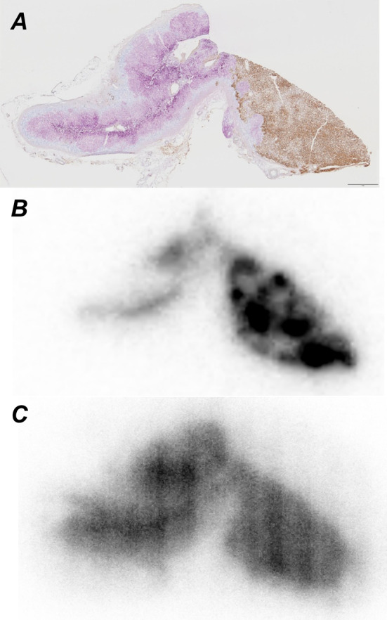 Development of a CYP11B2 imaging tracer for primary aldosteronism: basic evaluation of iodine- and fluorine-incorporated pyridinyldihydroquinolinone derivatives