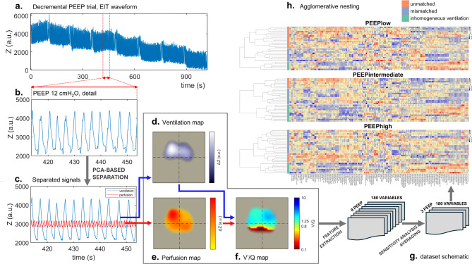 Omics approach to chest electrical impedance tomography reveals physiological cluster of ARDS characterised by increased respiratory drive and effort.