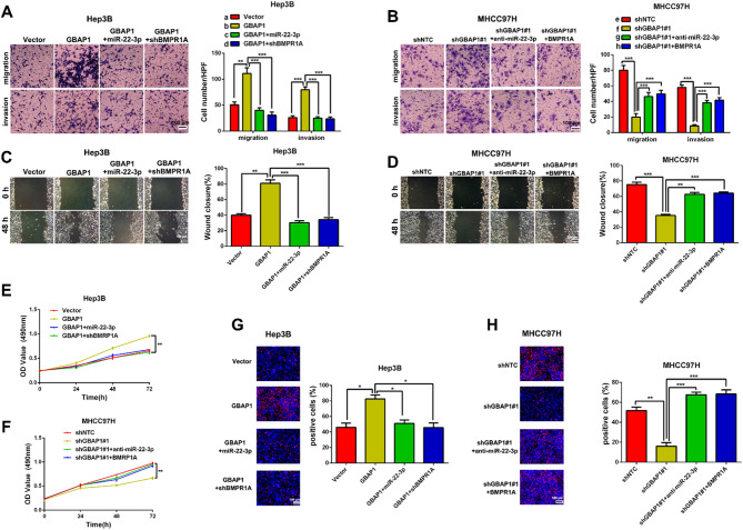Correction: METTL3-induced lncRNA GBAP1 promotes hepatocellular carcinoma progression by activating BMP/SMAD pathway.