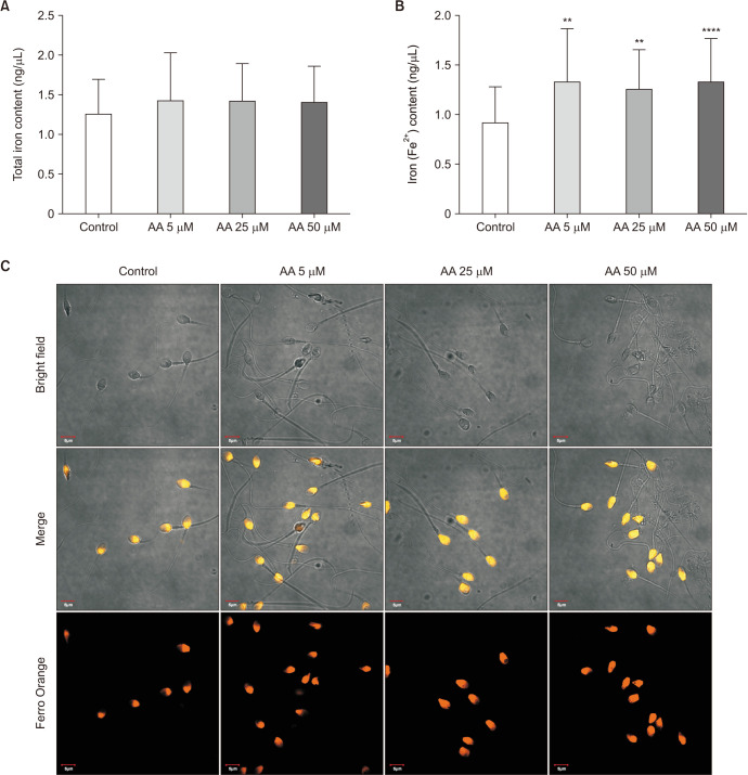 Oxidative Stress Induces Changes in Molecular Markers Associated with Ferroptosis in Human Spermatozoa.