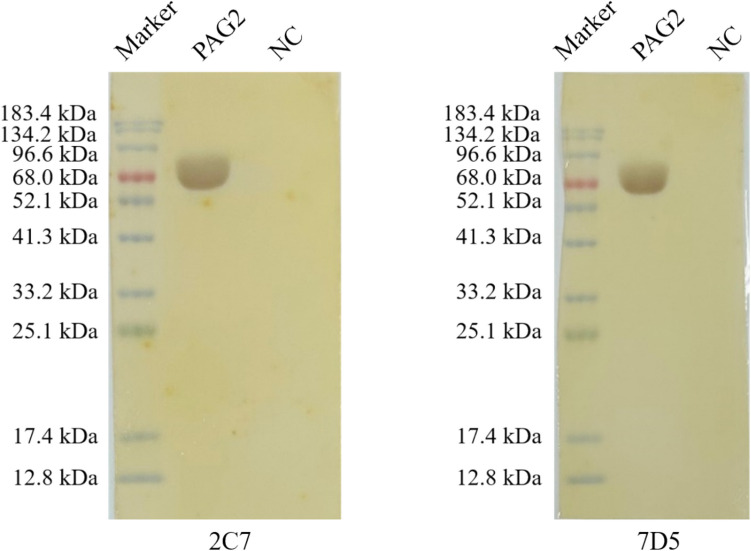 Establishment of a latex immunochromatography for detecting bovine early pregnancy-related glycoproteins.