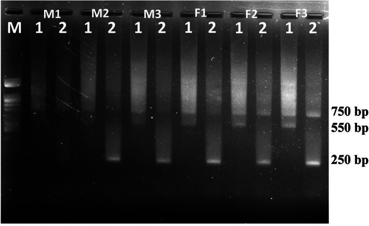 Anthelmintic effects of Areca catechu L. (Arecaceae) and Piper betle L. (Piperaceae) combination on adult Haemonchus spp.: a scanning electron microscopy study.