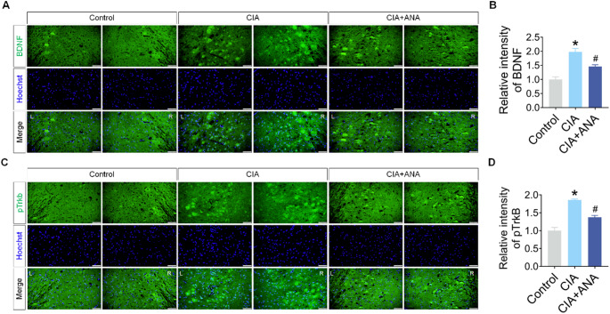 ANA-12 Targets and Inhibits BDNF/TrkB Signaling to Alleviate Pain Behaviors in Rheumatoid Arthritis Mice