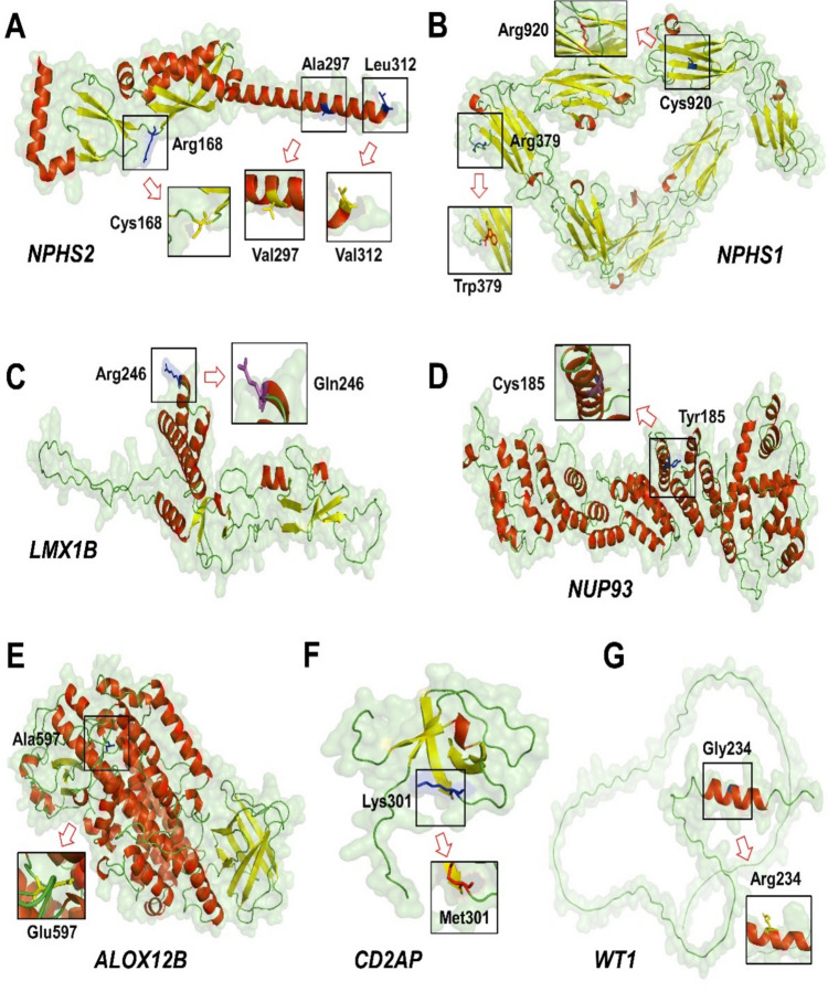 Whole genome sequencing identifies monogenic disease in 56.1% of families with early-onset steroid-resistant nephrotic syndrome.