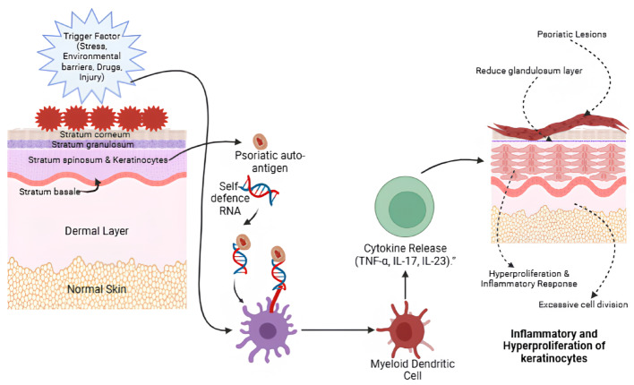 Recent advancement of fisetin-based nanoformulations in the management of psoriasis.