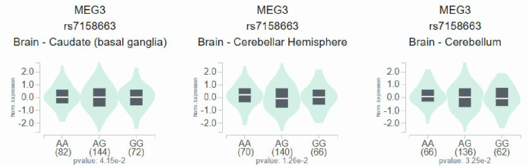 Association of long noncoding RNA MEG3 genetic variants with the risk of diabetic neuropathy.
