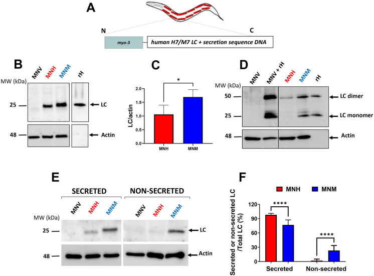 Modeling immunoglobulin light chain amyloidosis in Caenorhabditis elegans.