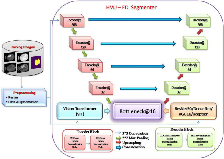 A novel hybrid vision UNet architecture for brain tumor segmentation and classification.