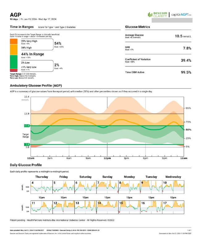 Pyloric Botulinum Toxin for Diabetic Gastroparesis: A Case of Sustained Glycaemic Improvement.