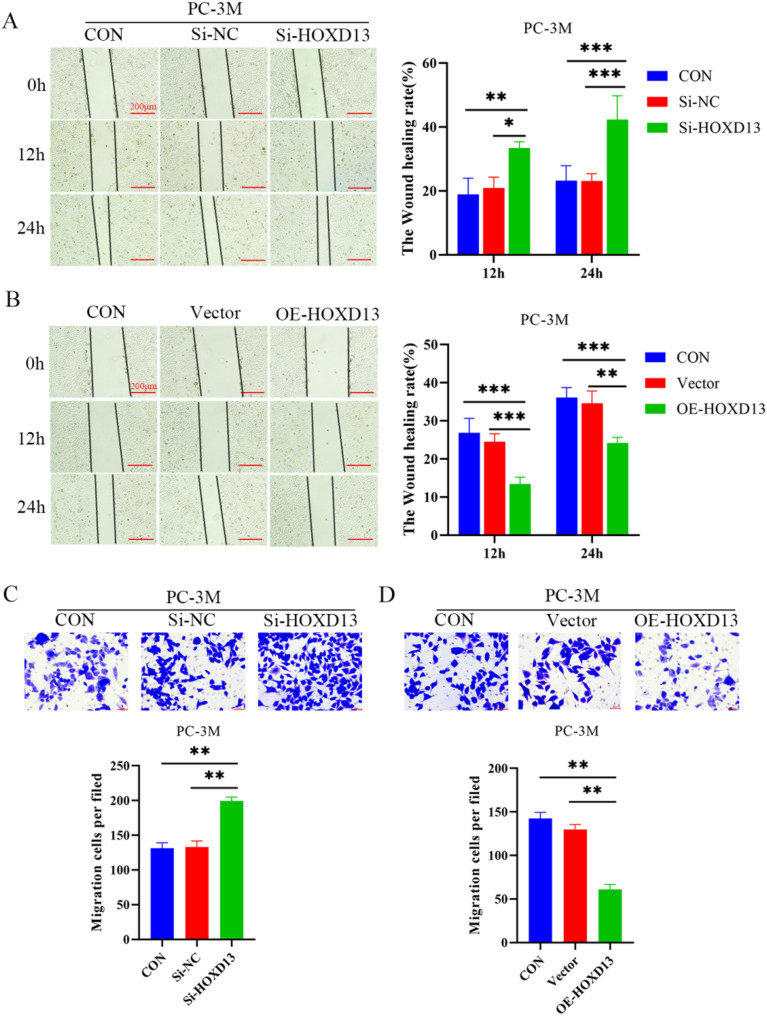 HOXD13 knockdown attenuates apoptosis in prostate cancer via the upregulation of MDM2/p53 signaling.
