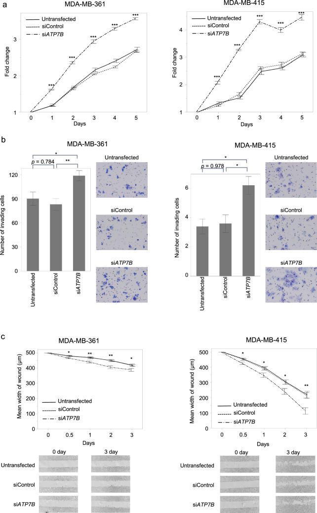 ATPase copper transporting beta attenuates malignant features with high expression as an indicator of favorable prognosis in breast cancer.