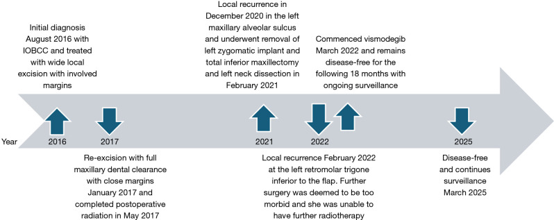 Case report of long-term disease control of recurrent intraoral basal cell carcinoma with vismodegib at two-year follow-up.