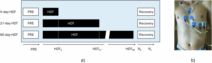 Heart rate variability adaptation due to head-down tilt bed rest: insights from pooled data of six campaigns.