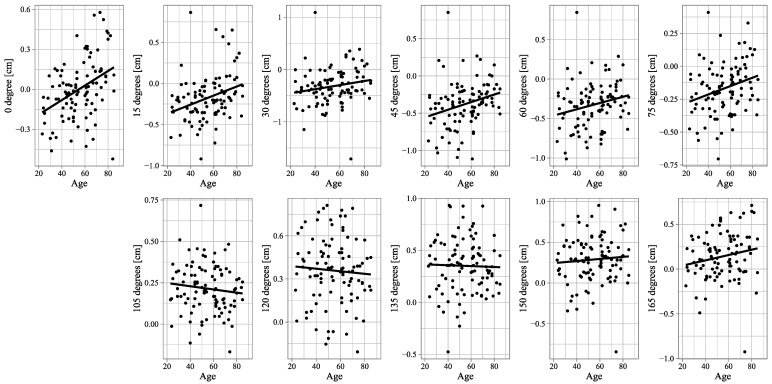 Vestibular Dysfunction and the Leftward Deviation in the New Line Bisection Task Using Three-Dimensionally Transformed Rectangles.