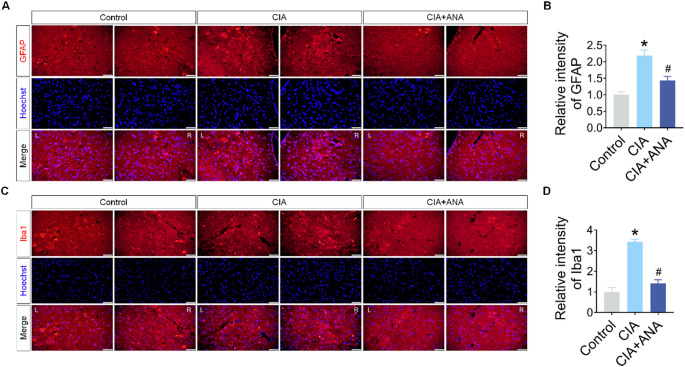 ANA-12 Targets and Inhibits BDNF/TrkB Signaling to Alleviate Pain Behaviors in Rheumatoid Arthritis Mice