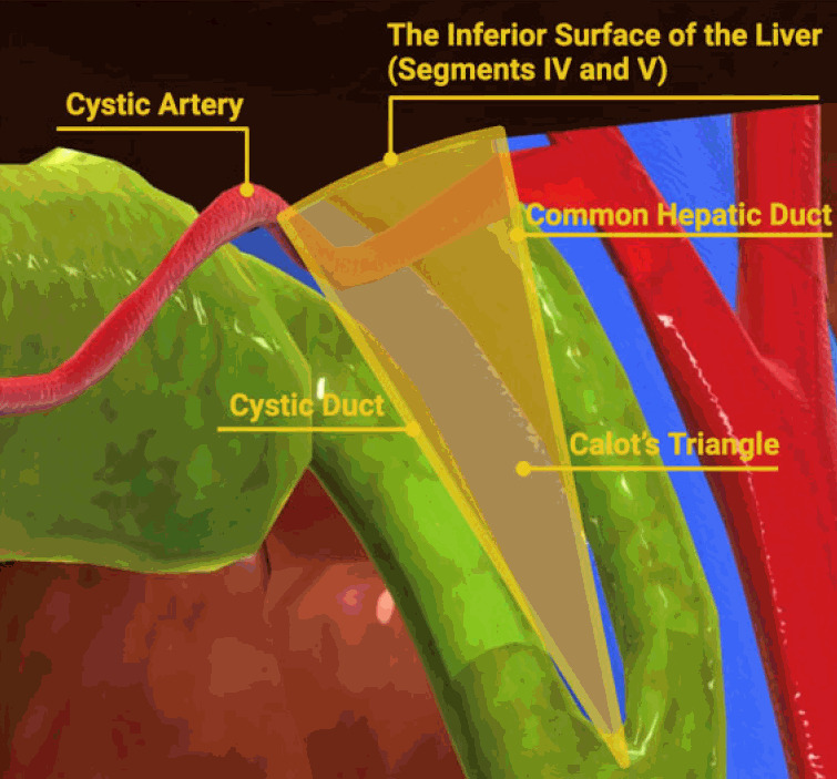 True natural orifice transluminal endoscopic surgery-transgastric cholecystectomy and beyond.