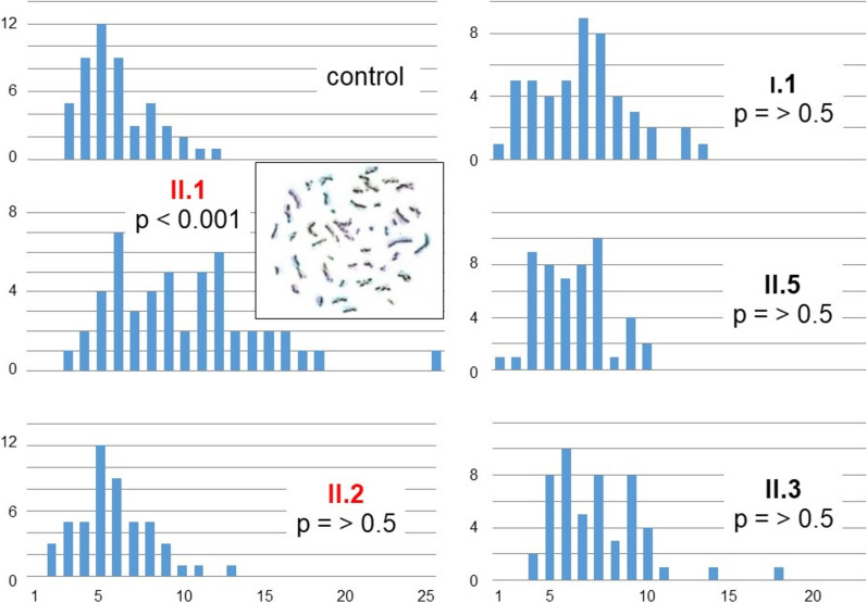 A homozygous TRIP13 pathogenic variant associated with familiar oocyte arrest and prematurely condensed sperm chromosomes.