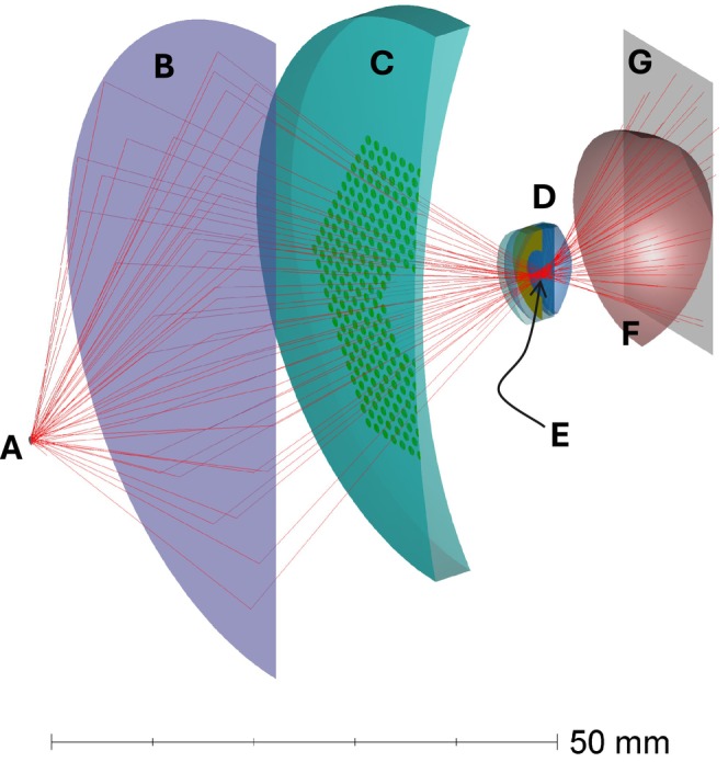 Retinal shadows of multisegment lenses in fundus imaging.