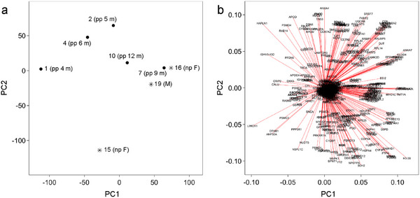 Proteomic Investigation of Human Dental Pulp to Identify Individuals Who Are Pregnant.