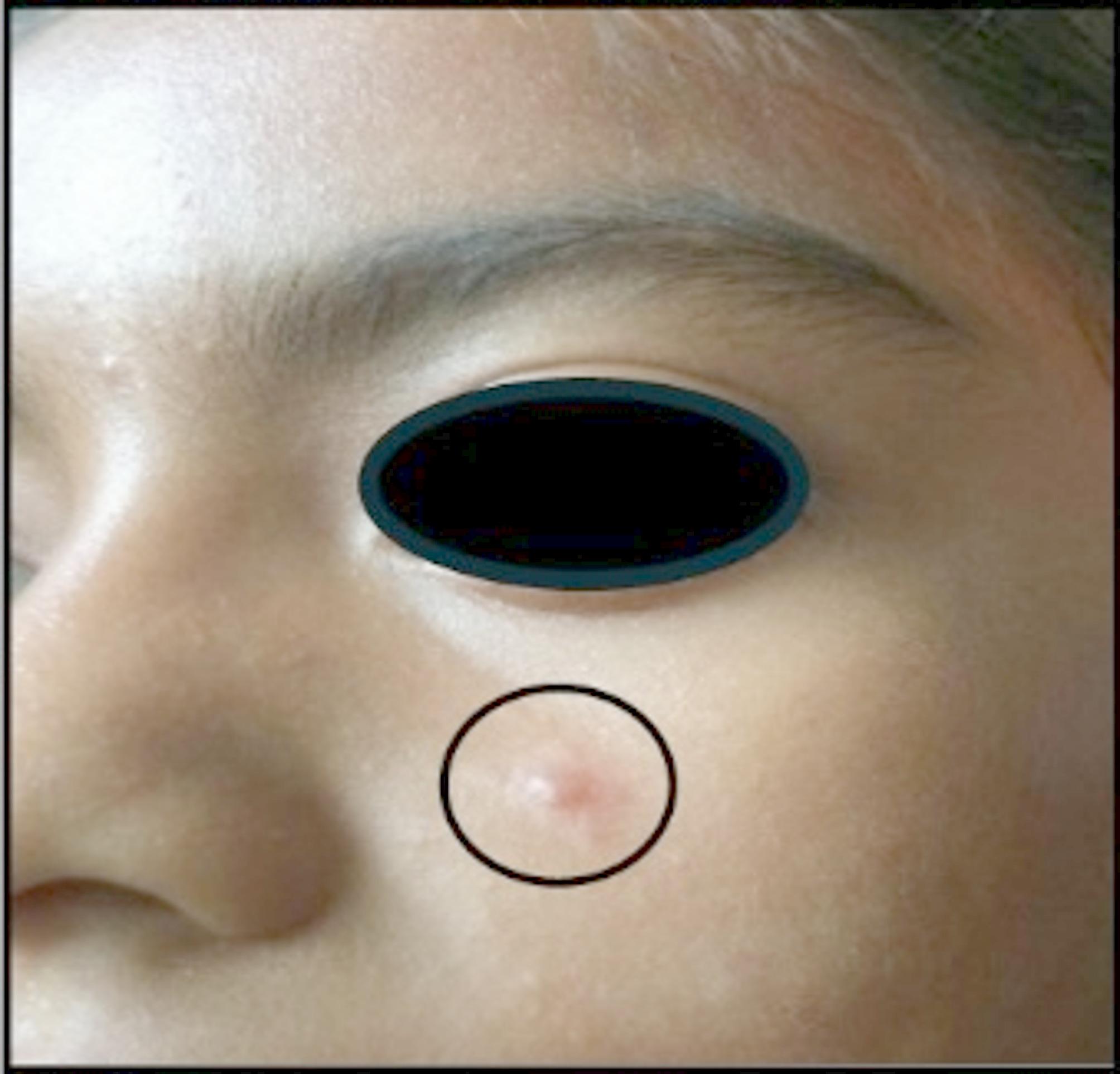 A comprehensive phenotypic and genotypic taxonomic review of Leishmania (Leishmania) poncei n. sp. (Kinetoplastea: Trypanosomatidae): a novel agent of cutaneous (non-ulcerated) and visceral leishmaniasis in Honduras, Central America.