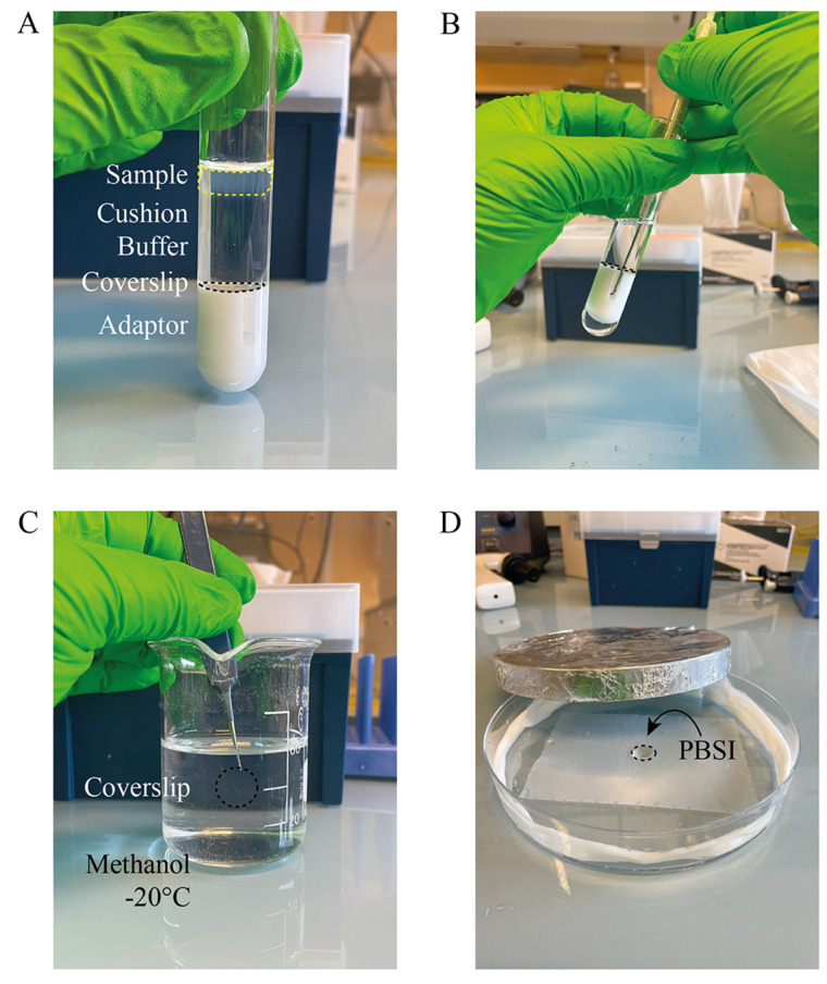 Fixation and Expansion Microscopy of <i>Xenopus</i> Egg Extract Spindles.