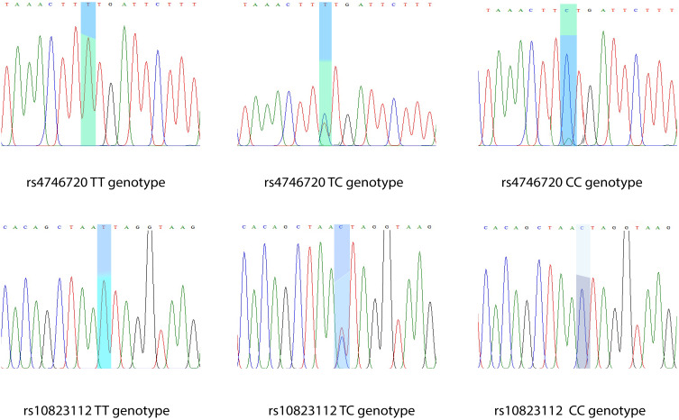 Molecular Variants in <i>SIRT1</i> Gene Among Saudi Women Diagnosed with Gestational Diabetes Mellitus: A Case-Control Study.