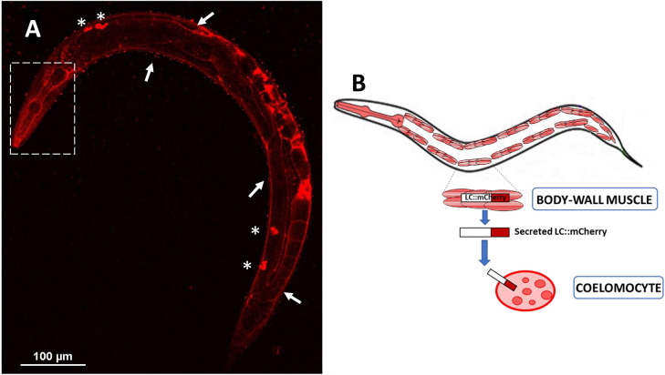 Modeling immunoglobulin light chain amyloidosis in Caenorhabditis elegans.