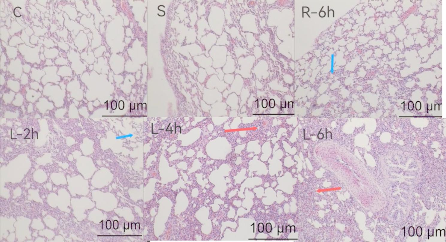 High tidal volume mechanical ventilation exacerbates pulmonary injury via upregulation of PAI-1 expression in rats.