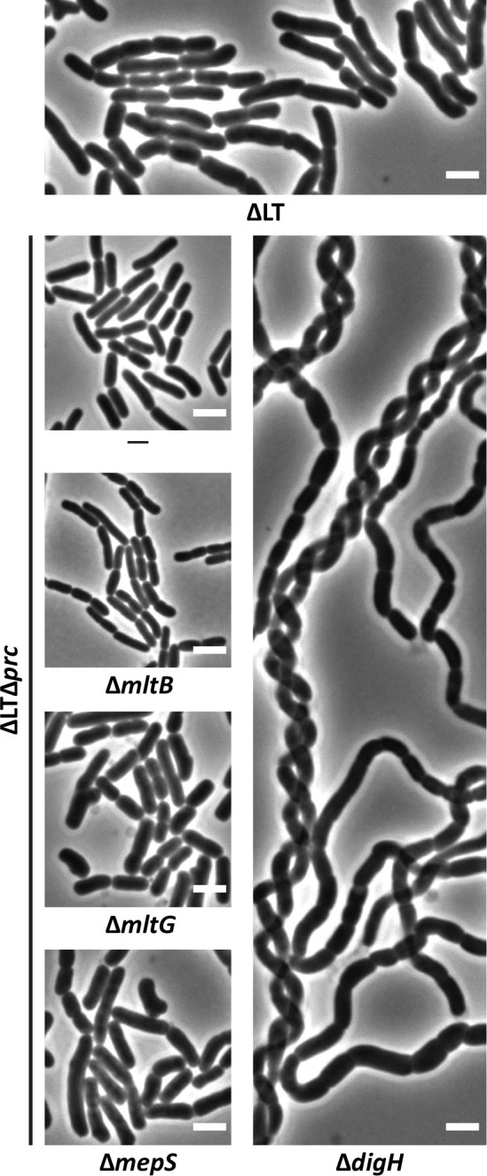 The DigH glycosyl hydrolase is conditionally required for daughter cell separation in <i>Escherichia coli</i>.