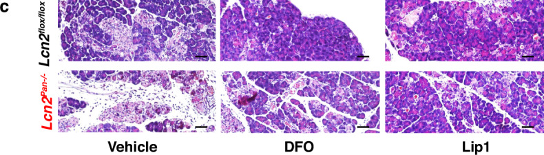 Author Correction: NUPR1 is a critical repressor of ferroptosis.