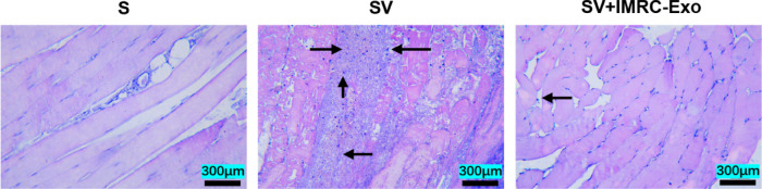 IMRC-exo alleviates limb injury by inhibiting ferroptosis in a rabbit model of deinagkistrodon acutus snakebite envenomation.