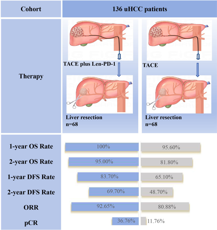 TACE Combined with Lenvatinib-PD-1 Versus TACE Monotherapy as Conversion Therapy Before Liver Resection in Unresectable Hepatocellular Carcinoma: A Retrospective, Propensity Score Matching Study.
