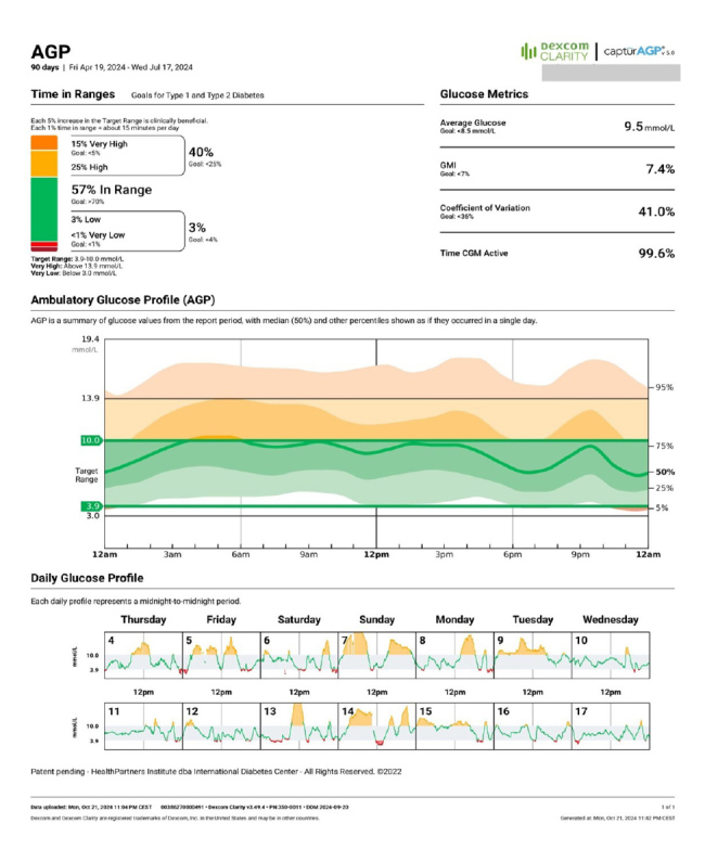 Pyloric Botulinum Toxin for Diabetic Gastroparesis: A Case of Sustained Glycaemic Improvement.