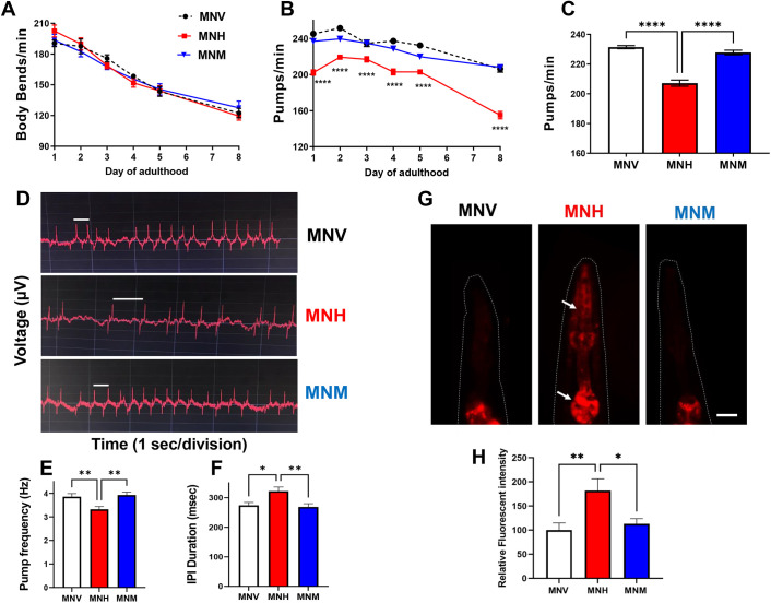 Modeling immunoglobulin light chain amyloidosis in Caenorhabditis elegans.