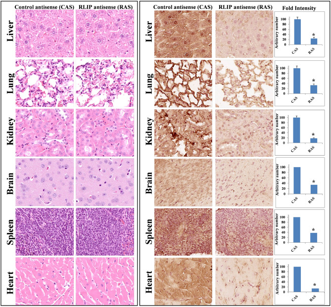 Targeting the oncoprotein RLIP as novel therapy for ovarian cancer.