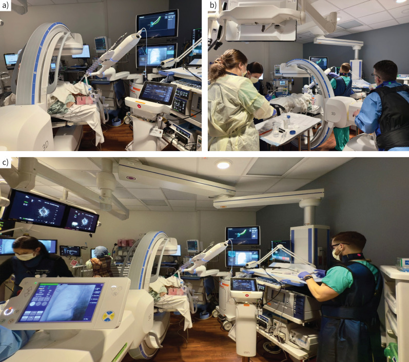 Development and deployment of robots in a bronchoscopy suite.