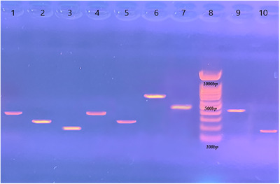 Investigating the Prevalence of Enterotoxin and Antibiotic Resistance in Methicillin-Resistant Staphylococcus aureus (MRSA) Isolated From Meat and Edible Viscera of Broiler Chickens.